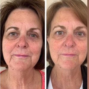 woman 7 before and after