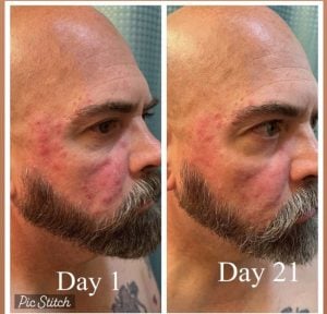 man before and after