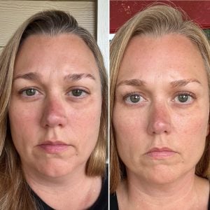 woman 6 before and after