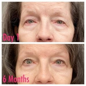 woman 3 before and after