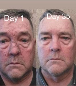 man before and after