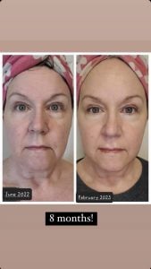 woman 2 before and after