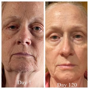 woman before and after