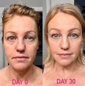 woman 8 before and after