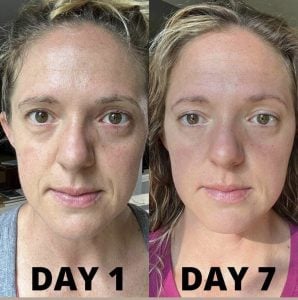 woman 1 before and after
