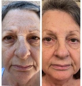 woman 9 before and after