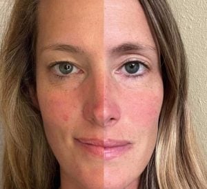 woman 10 before and after
