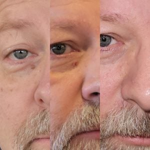 man before and after