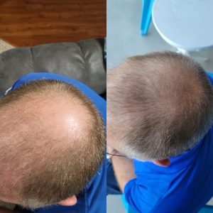 hair before and after