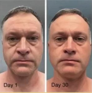 man before and after