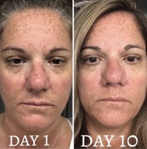 woman 5 before and after